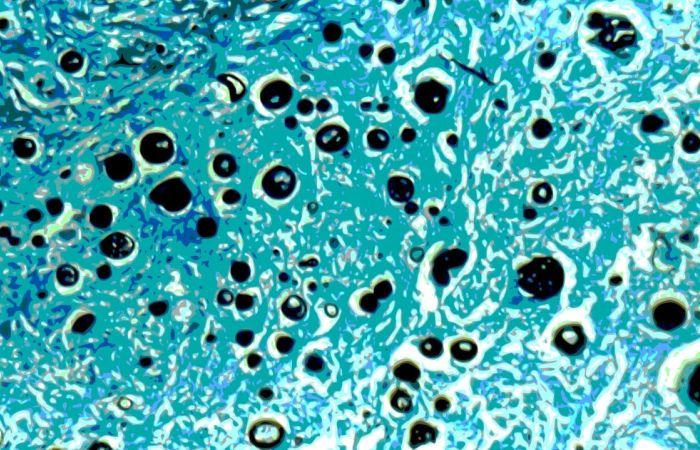 metabolism texture